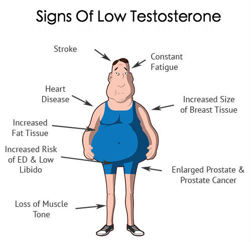 Low Testosterone Symptoms